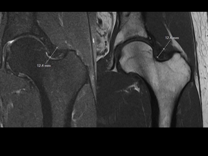 Figure 1 for case joint capsule ( RID6072 )